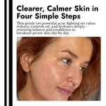 Acne Reduction Skincare Bundle - cieme