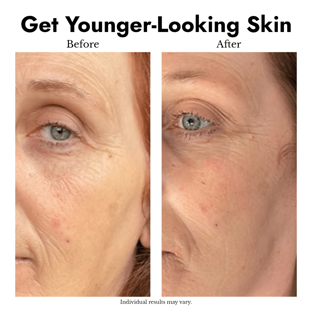 Anti - Ageing Skincare Bundle - cieme