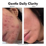 Hydrating Foam Wash - cieme