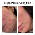 Moroccan Clay Mask - cieme