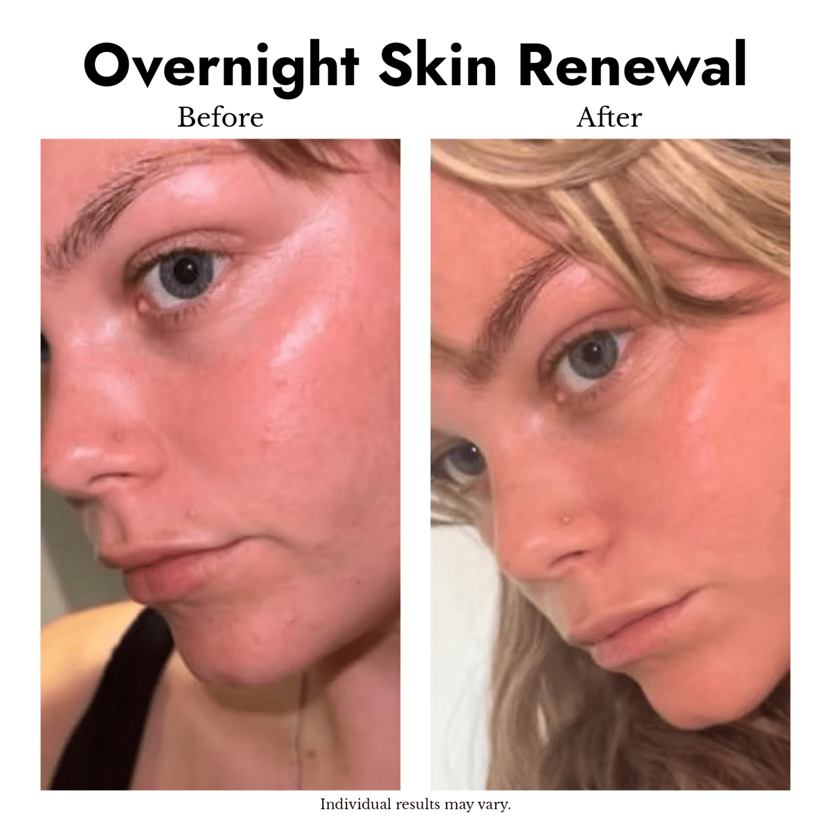 No Filter Enzyme Night Cream - cieme